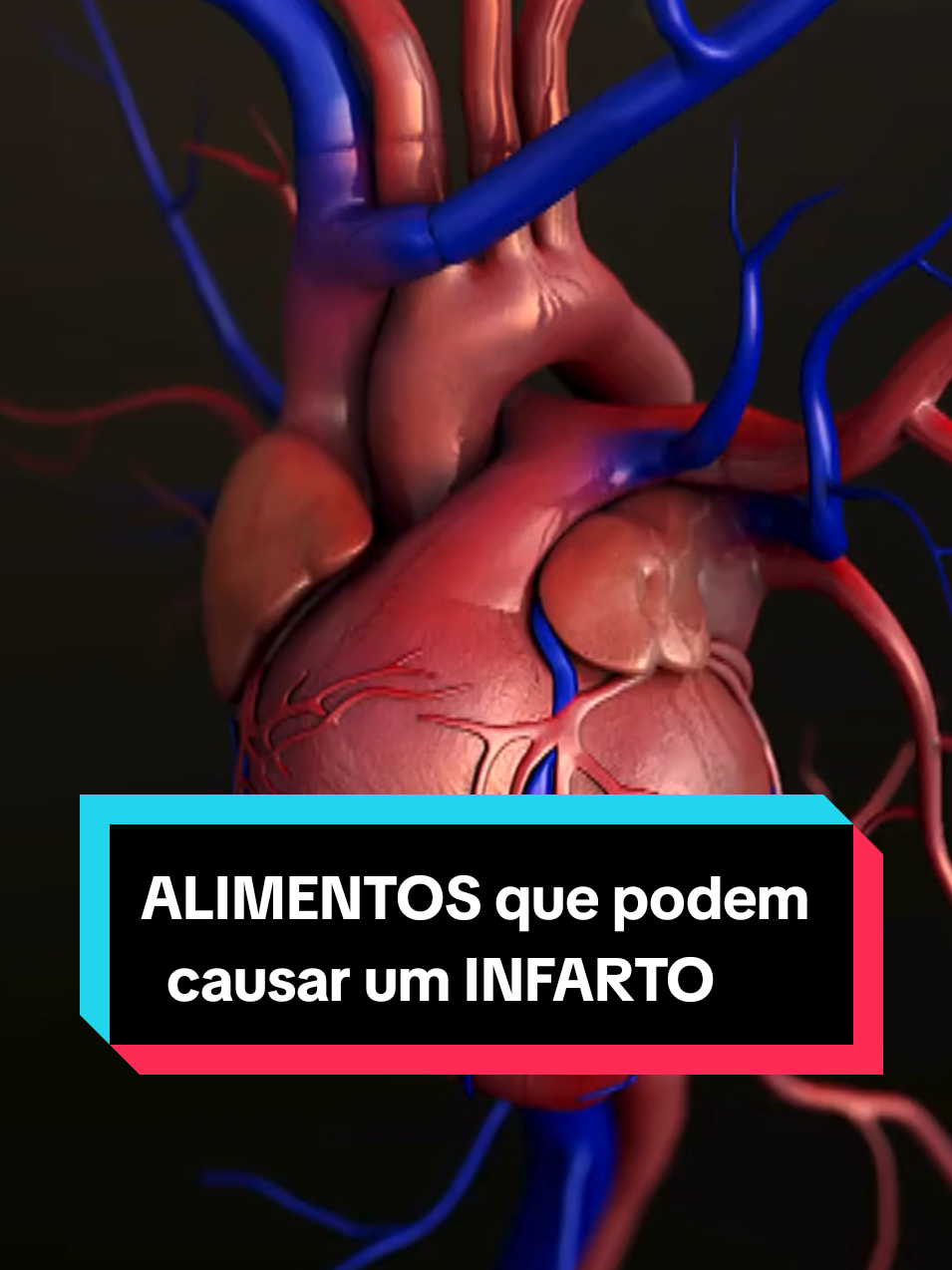 Alimentos que podem causar um Infarto #coracao #infarto #junkfood 