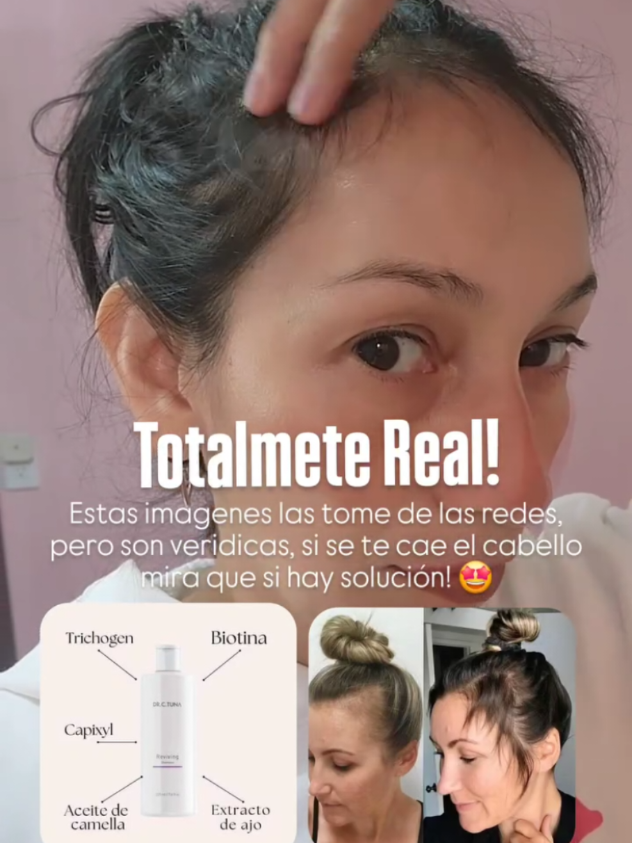 Shampoo reviving de farmasi!  ESTE SHAMPOO TIENE 3 COMPONENTES IMPORTANTES ✅AJO que evita la inflamación del folículo para que el cabello no se caiga de manera innecesaria ✅CAPIXYL que es un complejo bio-activo diseñado para prevenir la caída del cabello y estimular el crecimiento ✅BIOTINA que mejora la infraestructura de la queratina, una proteína básica que compone el cabello, así que puede mejorar la salud del cabello, incluyendo el volumen y la cobertura del cuero cabelludo.  #farmasi #reviving #shampooo #evitalacaida  #crecimientodecabello #tratamientocapilar #alopecia 