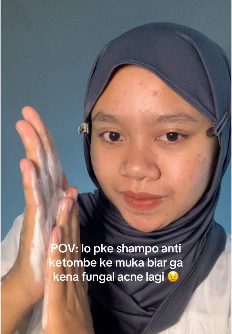 tebak, brand mana yg mendengarkan keluh kesah acne fighter ini?! 