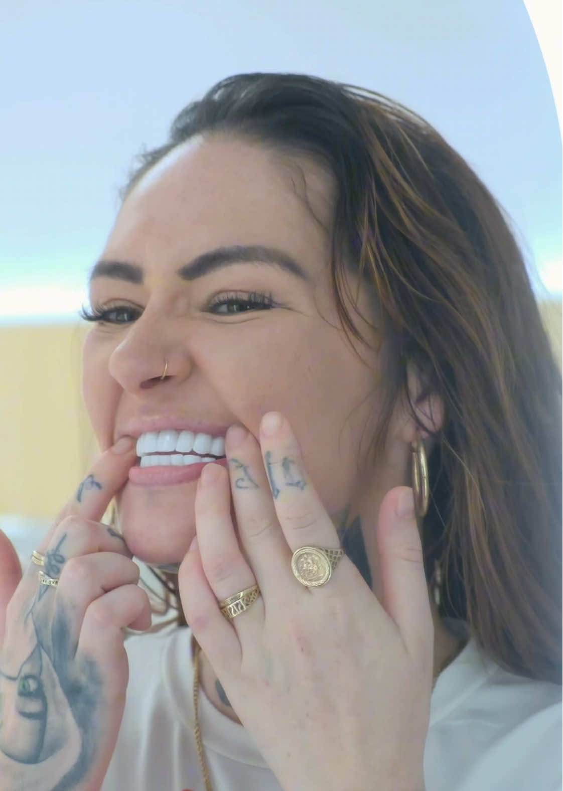 Charming Shannon with an amazing smile.. ✨ #designprowhite #zirconiumturkey #zirconiumcrown #zirconiumveneer #dentalveneer #smilemakeover #smiledesign #whiteteeth #newteeth #cosmeticdentist #dentalturkey #dentalantalya #dentaldesign #dentaldesignturkey #england #uk #ireland #unitedkingdom #liverpool #london #smiley #essex #dentalesthetics #dentistinantalya #dentistinturkey #smile #belgium #america #usa