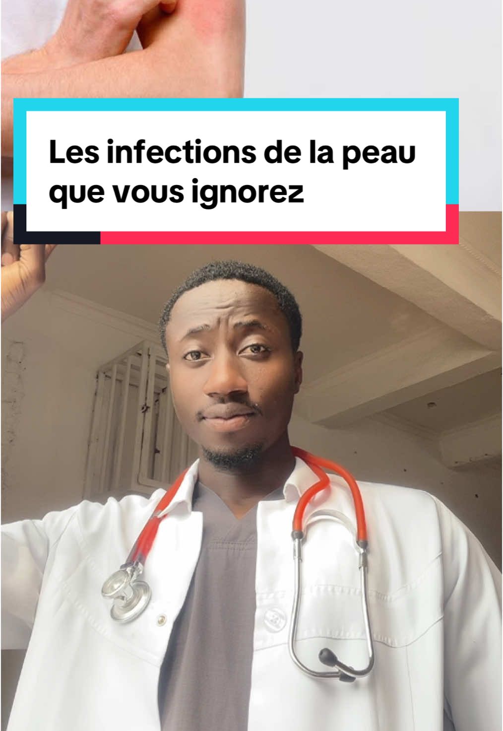 #Infections #Peau #Dermatologie  #Signes #symptômes 