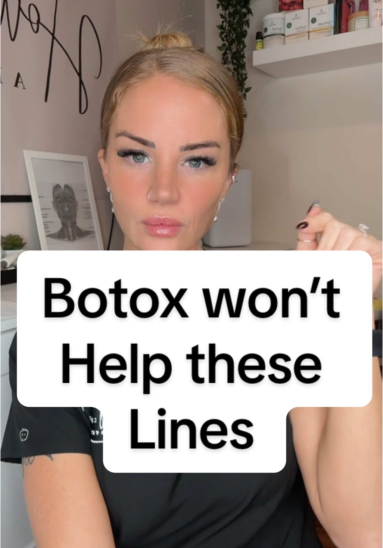 You won’t be able to get rid of lines with Botox that are not caused by muscle movement.  #botox #aesthetics #hollylouiseaesthetics #fyp #sleeplines #staticlines #smoothskin #antiaging #botoxgonewrong #