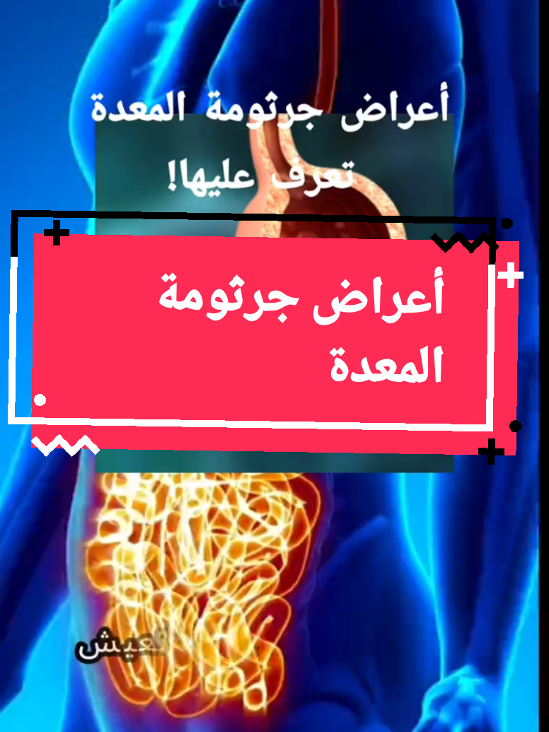 #أعراض_جرثومة_المعدة #جرثومة_المعدة #المعدة #أعراض #الصحة #معلومات #المغرب🇲🇦تونس🇹🇳الجزائر🇩🇿 #فرنسا🇨🇵_بلجيكا🇧🇪_المانيا🇩🇪_اسبانيا🇪🇸 #فوريو #اكسبلور #فوريو_العرب 