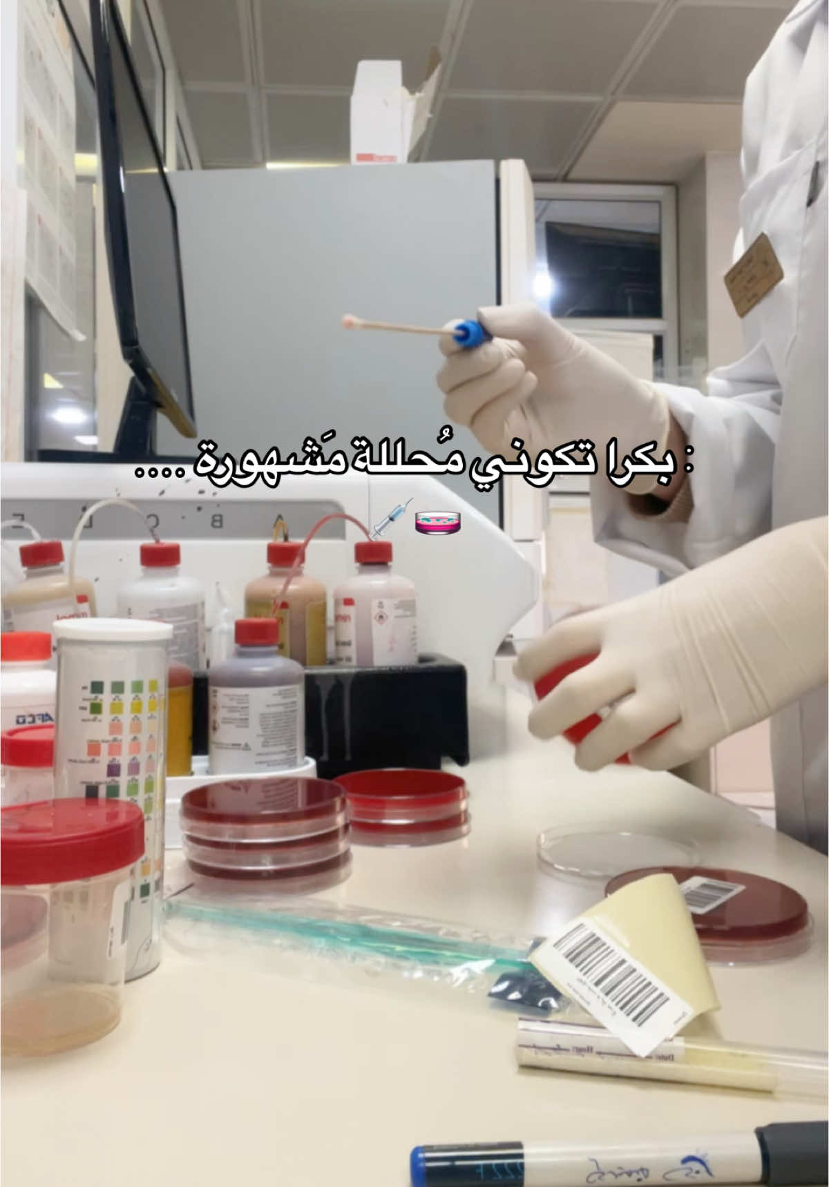 تاغ لاحلى محللة بتعرفوها…🩸💉 #تحاليل_طبية #طب_مخبري💉👩🏻‍🔬 #مخبرية #foryoupage #foryou #fyp #explore #جامعةالنجاح_الوطنية 