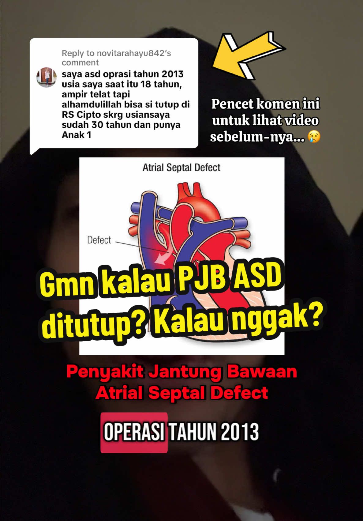 Replying to @novitarahayu842 keren.. semoga teman-teman ASD & PJB lainnya, termasuk orang tua dan calon orang tua makin aware (sadar) bahwa kondisi ini bisa lho disembuhkan, ga usah takut operasi 👍