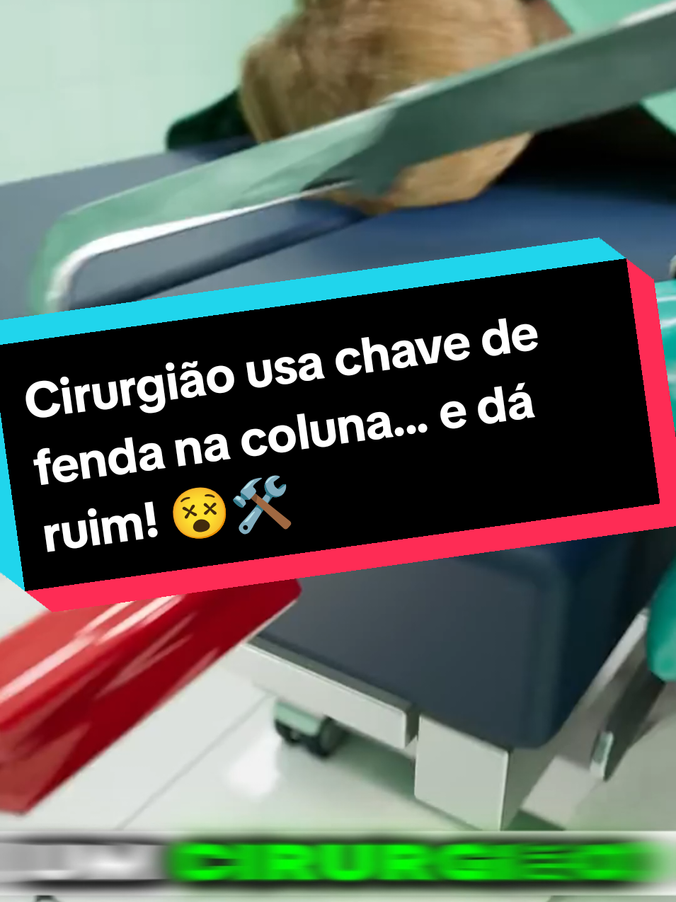 Cirurgia deu errado: Chave de fenda na coluna! 😨🛠️ #curiosidades  😱 #históriasreais  🏥 #mistériosdavida  🤯 #fatosinacreditáveis  🔍 #CirurgiaFail  🛠️ #choquederealidade  ⚡ #fiquepordentro  📲 #tiktokbrasil  🇧🇷 #paravocê  💥 #Trendin 