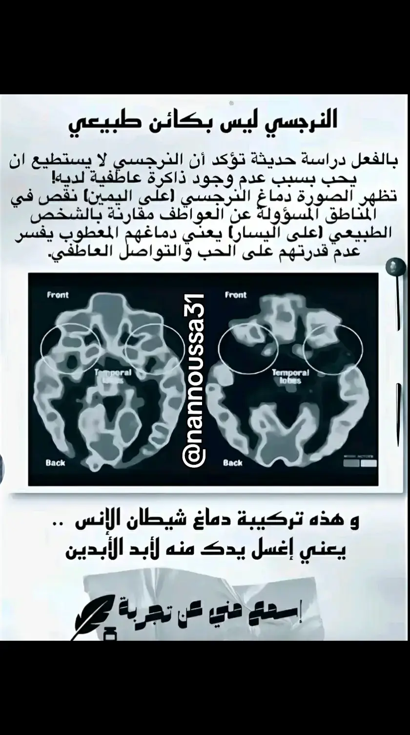 #psychology #علم_النفس #النرجسية #سيجما 