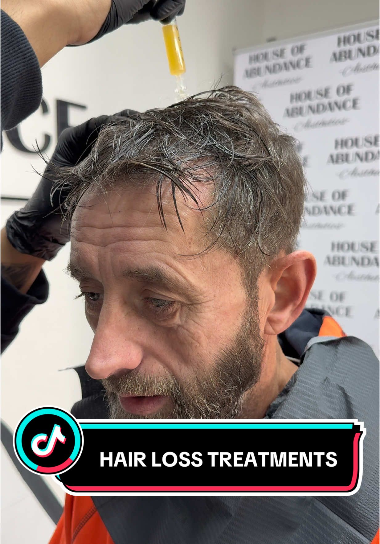 HAIR LOSS TREATMENTS!! #hairlosssolutions #hairlosssolutions #hairgrowthtips #prp #exosome #exosomes 