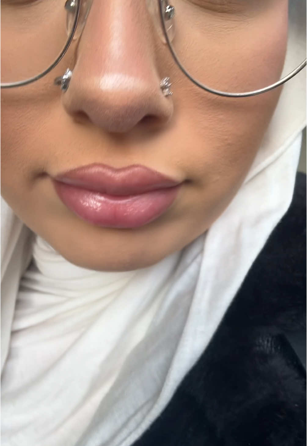 🤍 #fyp #goviral #lipfiller #newme #halal 