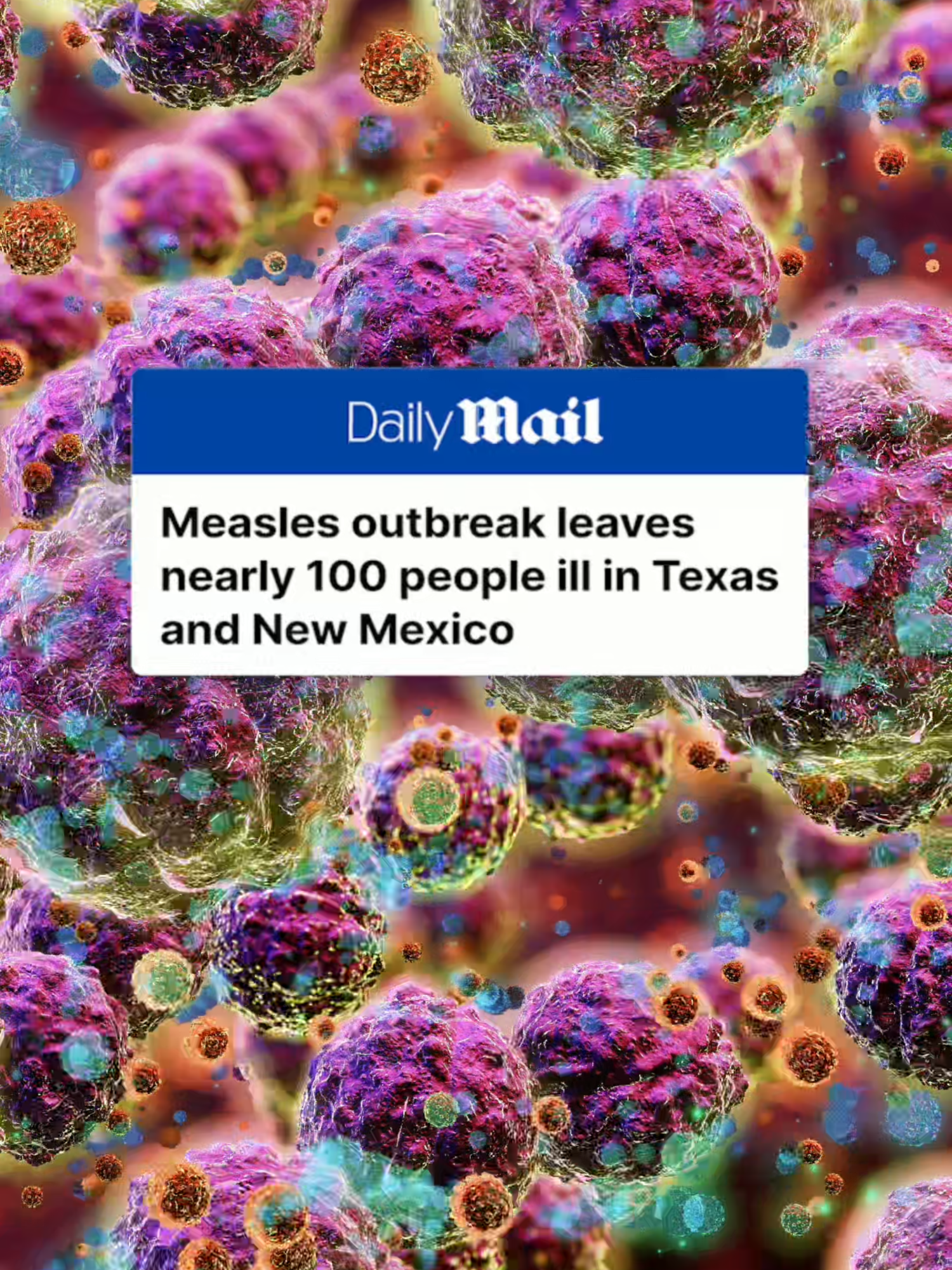 Health officials in two US states are tracking measles outbreaks as cases rise to nearly 100 people. In Texas, the health department is aware of 90 cases in the last month. At least 77 of them were reported in children and teens under 17. In New Mexico, officials said nine people had become sick. The outbreaks come amid a rise in US 'anti-vaxing', including towards the measles, mumps and rubella jab that is typically given during childhood. But health experts say that the disease could be controlled or even eradicated with proper inoculation rates. Read more at DailyMail.com #antivaxxer #vaccine #newmexico #texas #usa #outbreak