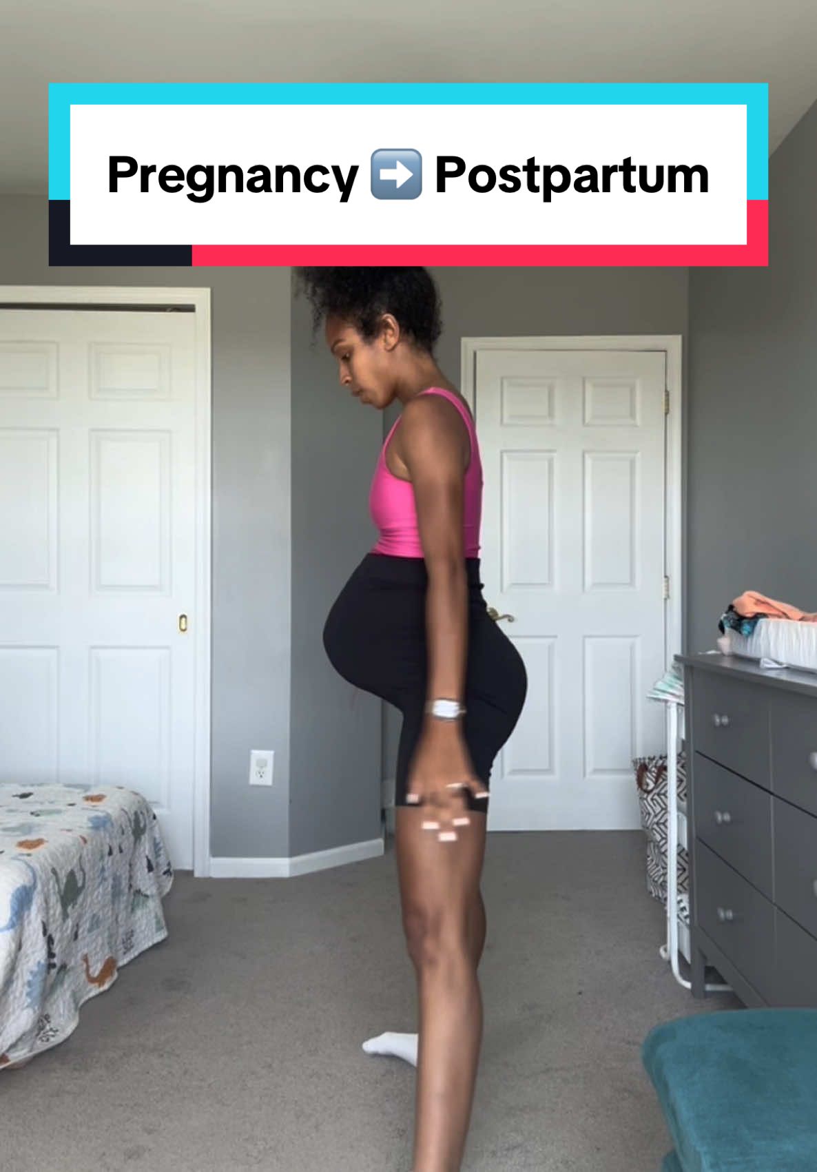 A smooth birth, not a single pelvic floor issue, & Diastasis is almost healed at 6 months postpartum 🥲 #postpartumbody #postpartumjourney #pregnancyjourney #pelvicfloor #diastasisrecti #pelvicfloorexercises 