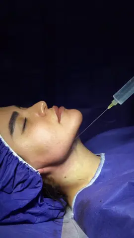 متخليش التفاصيل الصغيرة تخفي جمالك الحقيقي 😍 وخلي دقنك متحددة واتخلصي من اللغد اللي مدايقك بشكل نهائي 🥰 ✅ العملية بتتم في 30 دقيقة بس بكل آمان ودقة عالية  ✅ نتائج العملية دائمة وبدون أي ألم  ✅ هتتخلصي من اللغد بشكل نهائي  هترجعي جمال ملامحك من تاني 😌 تغيير صغير هيفرق كتير في جمالك لما تحجزي ميعادك دلوقتي في Elegant Clinic ✨ 📞 للحجز والاستفسار:  01015062570 📌 اﻟﻌﻧوان : ١١ ش اﺣﻣد ﺗﯾﺳﯾر - ﻣﺻر اﻟﺟدﯾدة اﻣﺎم ﻛﻠﯾﺔ اﻟﺑﻧﺎت #تجميل #تجميل_الوجه #تجميل_جمال_البشره_علاجات_للبشره #elegant #hair #hair #نحت_اللغد #لغد #ex #explore #expression #experiment #explorer #exo #explorar #exercise #tren #trendingvideo #trendingsong #trends #trendy @dr.mostafa.aboomar 