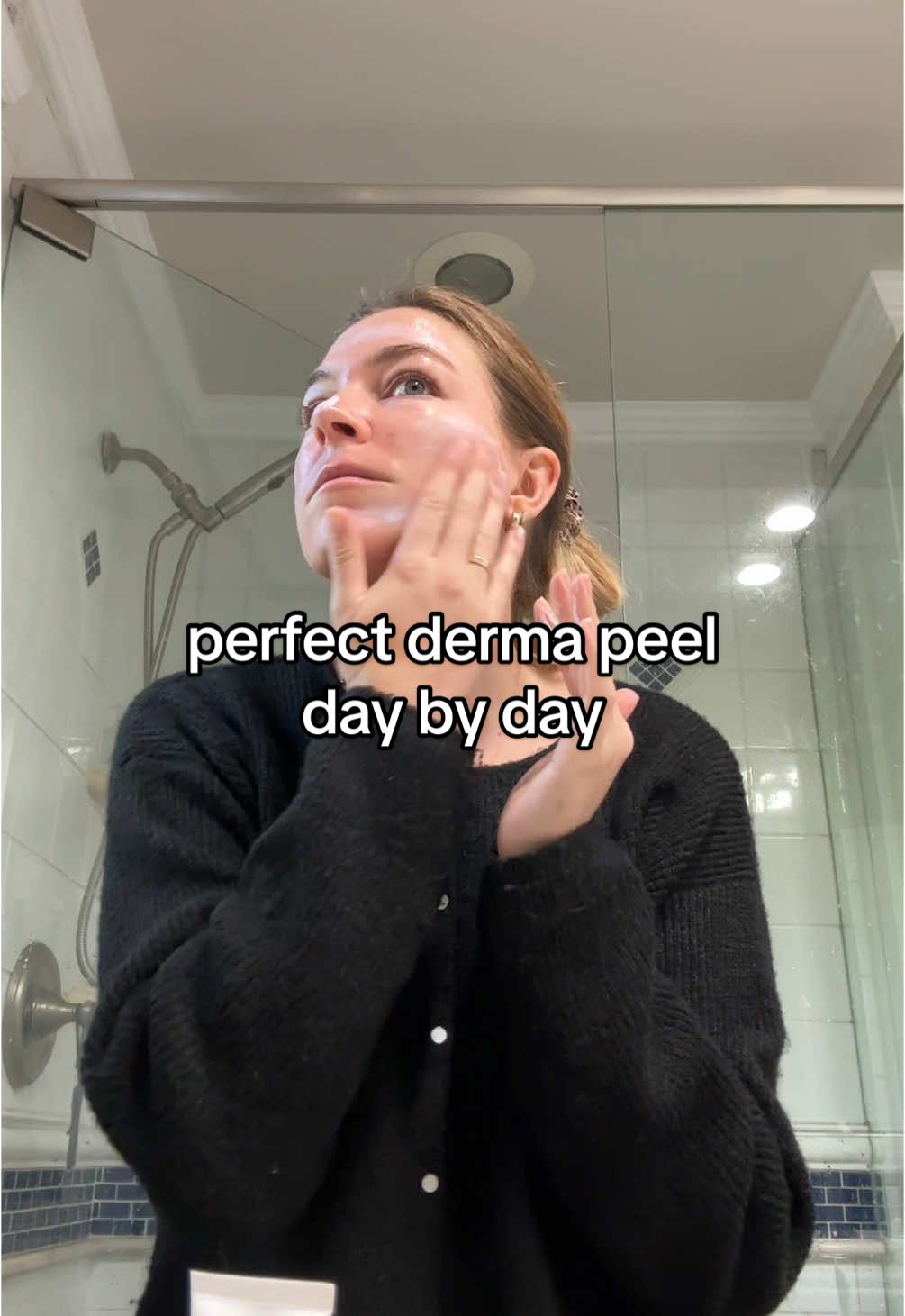 perfect derma day by day 🧖🏼‍♀️ what to expect day 1 of the perfect derma chemical peel  I will do a full perfect derma peel review once i’m done with the process - I am excited to see my skin peel and shed #perfectdermapeel #chemicalpeel @The Perfect Derma™ Peel  ##creatorsearchinsights