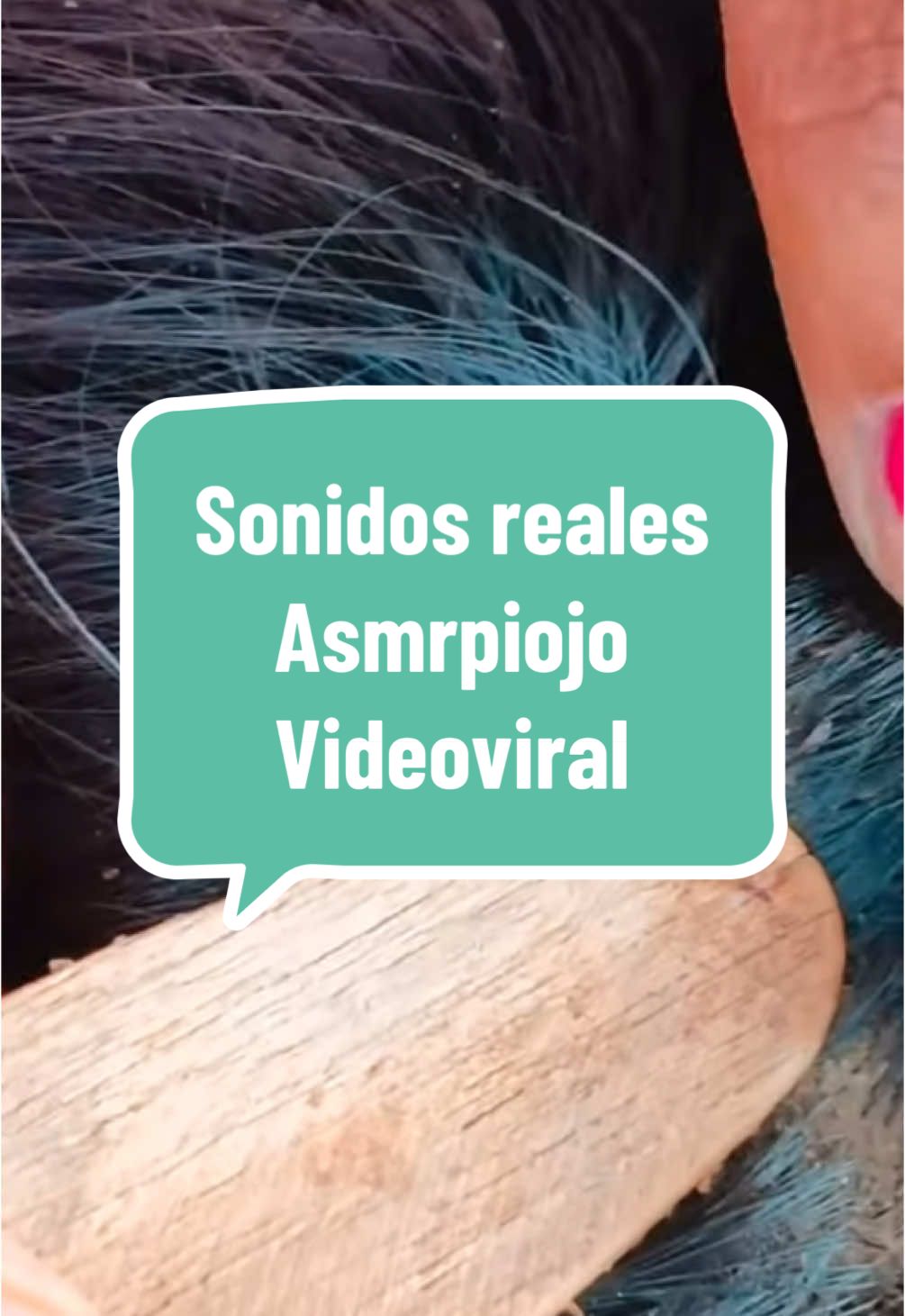 Abra segunda y tercera parte #videoviral #foryou #Asmrpiojo #despiojando 