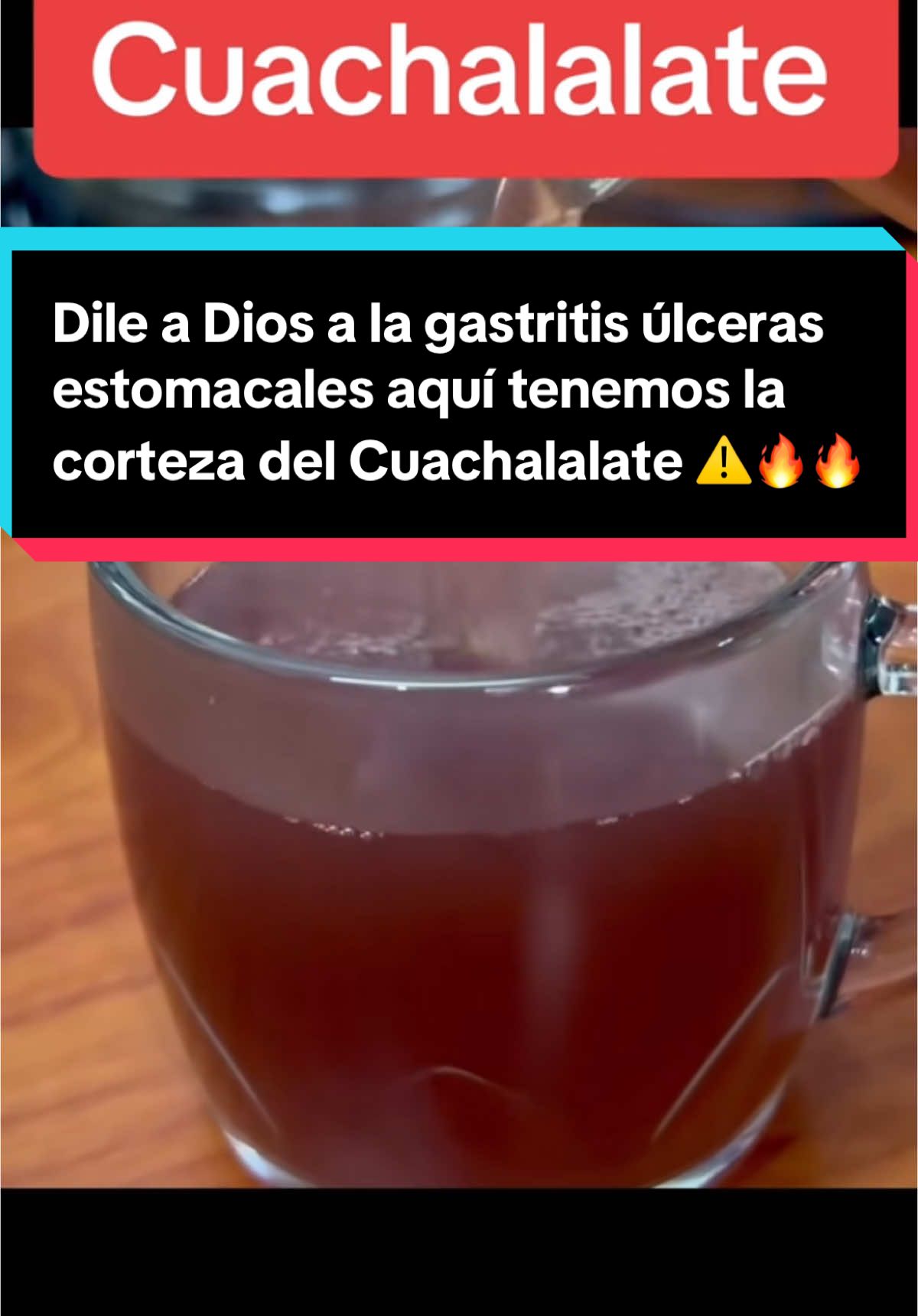 #recuerdos aquí tenemos disponible lo que es la corteza del Cuachalala también lo que es el diente de león para hacerte una limpieza hepática recuerda que las plantas naturales no sustituye ningún tratamiento recetado por un profesional de salud recuerda que cada cuerpo es diferente y siempre cualquier molestia consúltalo con tu médico#cuachalalate #tea #remedioscaseros #remediosnaturales 