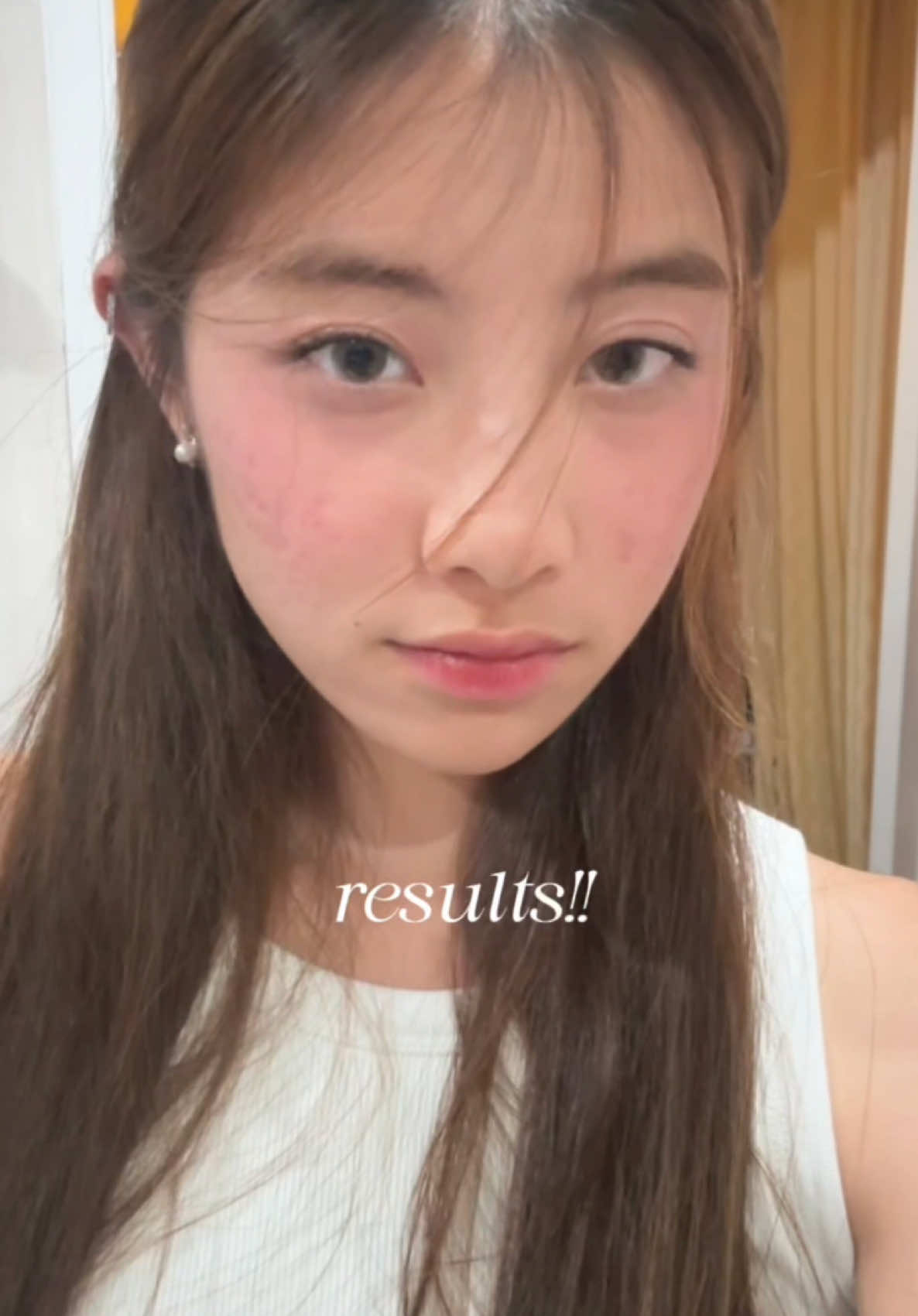 ✨✨ #SkintificTH 