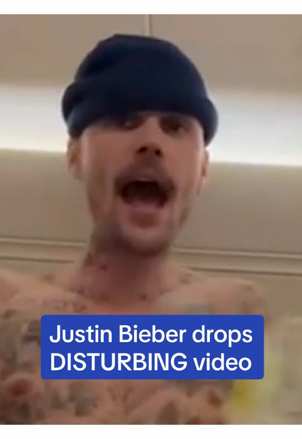 A new video of Justin Bieber performing a bizarre rap has sparked concern among his fans. Bieber's glassy-eyed appearance and monotone delivery concerned fans with one writing, 'Stop Justin. You are a new daddy.' The video comes days after Justin's rep denied that he was using hard d*ugs and claimed he looks hollow-eyed because he has been caring for his son who is struggling to sleep. Read more on DailyMail.com 🎥IG/JustinBieber #justinbieber #rap #celebrity #news 