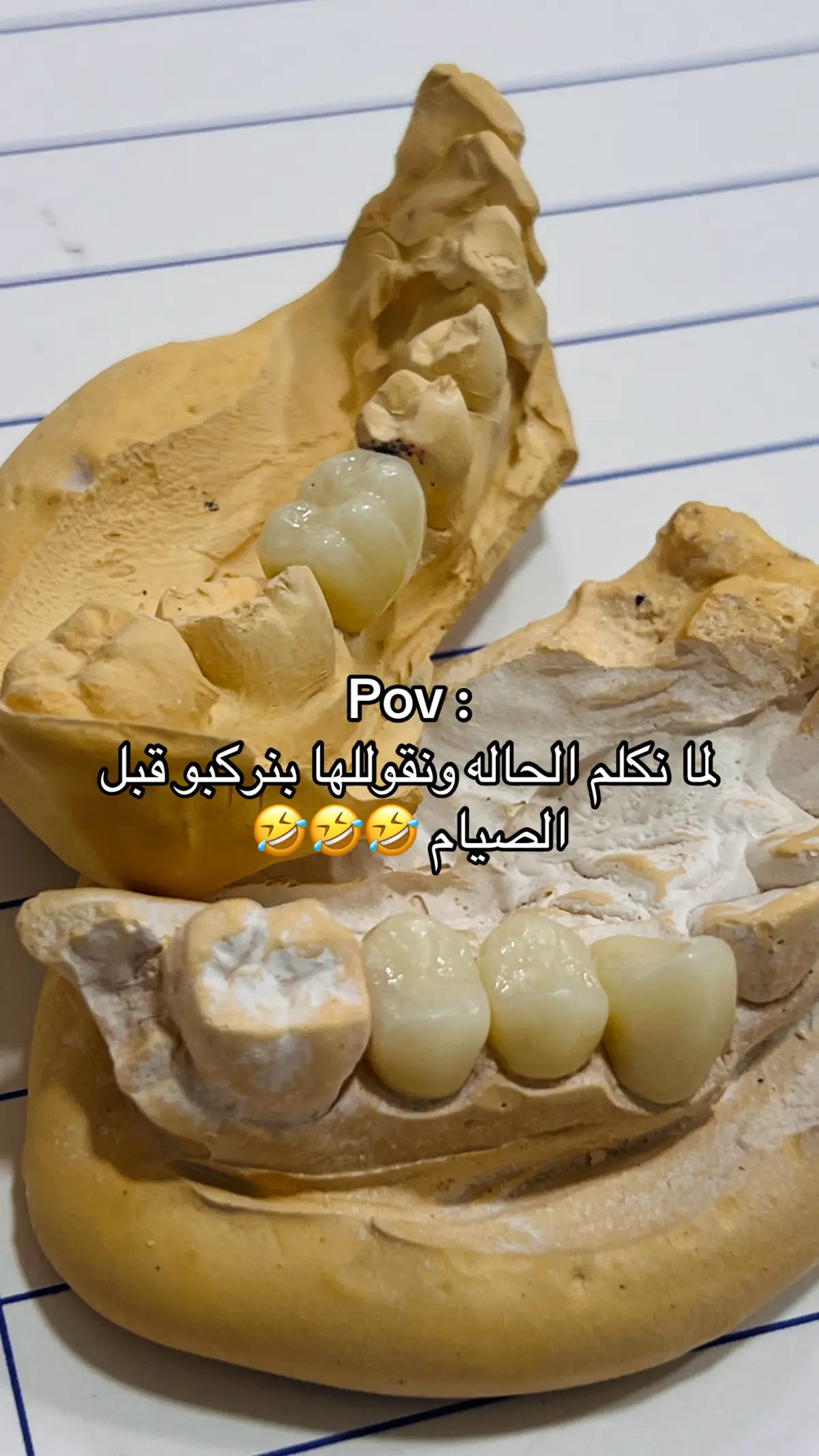 #طب_أسنان #مصراتة_ليبيا #سبها_ليبيا_الجنوب_الليبي #fyp #dentist 