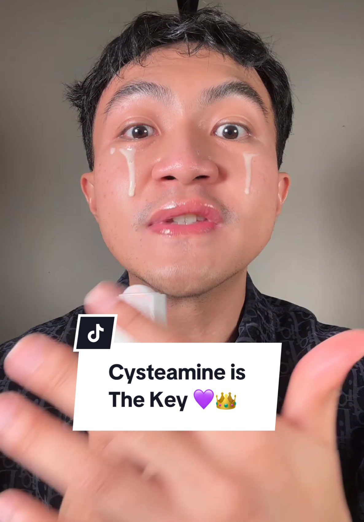 Setuju banget sama @Kamila Jaidi, MARS, AAAM cysteamine itu ingredients yang gong banget buat bantu cerahin dan pudarin dark spot! Wajib viral di tahun 2025 ini! 💜🥰👑✨ #kerajaanglowing #longervideos #shopmaster #skincareviral #skincare #belilokal #FinallyFoundYou #FinallySimple #serum #serumviral #brighteningserum #darkspotserum #cysteamine #sunscreen #sunscreenviral 