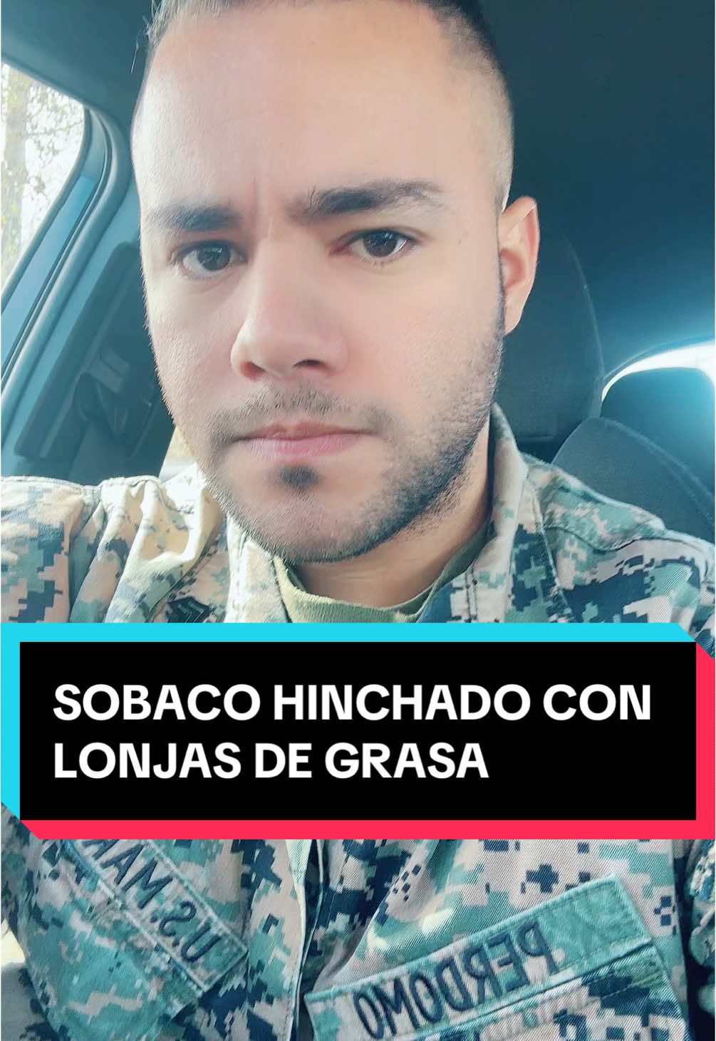 Sobaco hinchado con lonjas de grasa 