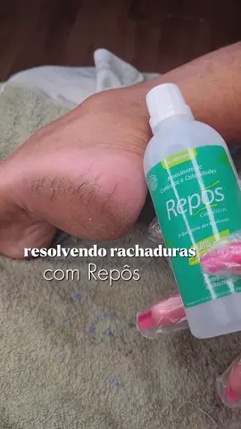 resolvendo rachaduras nos pés com Repôs | link do produto na bio  . . . #spadospes #repos #rachadurasnospés #pedicura #spadospés 