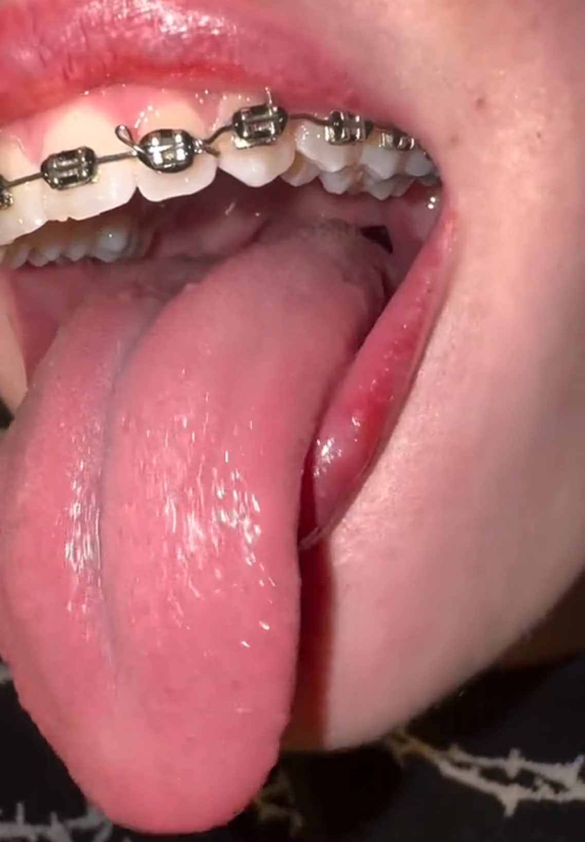 Mouth asmr  #asmr #mouthsounds #tongueasmr #mouthsoundsasmr #asmrvideos #tongue #mouth #braces 