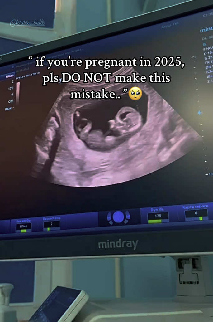 If you’re pregnant in 2025, pls do not this mistake…🥺 #baby #pregnant #pregnantlife #gift 