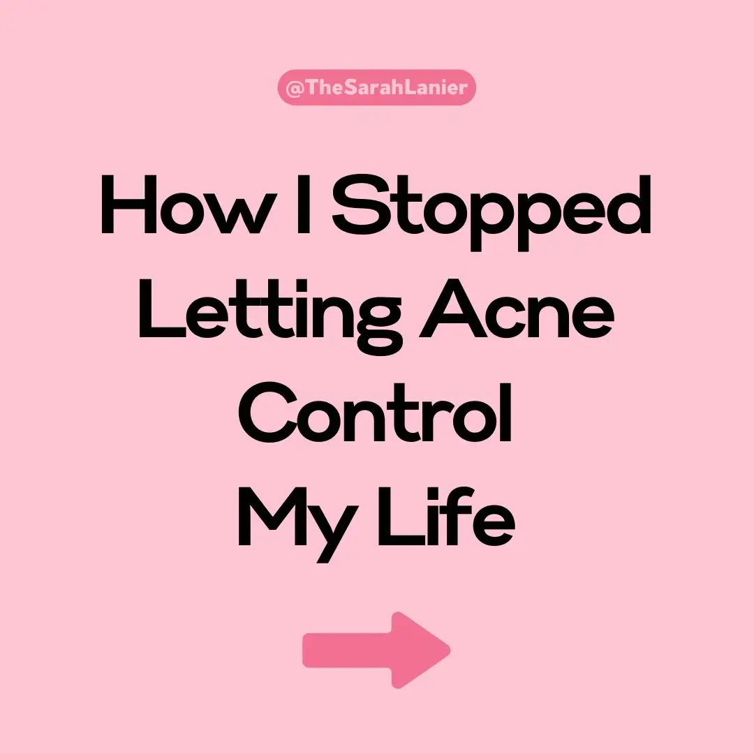 How I Stopped Letting Acne Control My Life... #acne #acnepositivity #skin #skinpositivity #acnecommunity #acneawareness #acneacceptance #acnejourney #acnesupport #acneempowerment #acneconfidence #cysticacne #acnescar #acnetreatment #acnefree #acnesolutions #acnecare #acnehealing #acnestruggles #acneskin #acneproblems #acnetips #skincare #acnerealtalk #acnetruth #acnerecovery #acneawarenessmonth #acneconfidence #acnehealing #acneinspiration