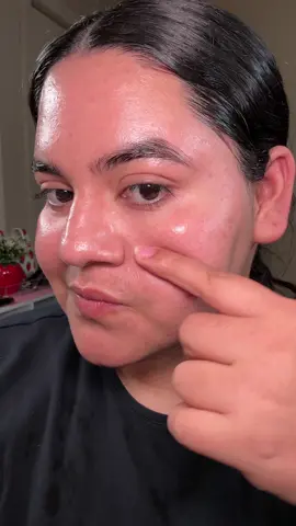 Skin regeneration with the MEDECA ACNIENCE & MEDECA CREAM @centellian24 offical @Centellian24_global  #Centellian24 #Centellian24Global #MadecaCream #SkincareEssentials #SkincareRoutine #GlowUp #BeautyTips #KoreanSkincare #KBeauty #Hydration #AntiAging #SkinCareAddict #YouthfulGlow #GlowingSkin #SelfCare #SkinCareGoals #SkinCareTips #RadiantSkin #glassskin #beautyproducts #cleansingfoam #facialcleanser #acneskincare #acnience #acnetreatment #acnepositivity #acnejourney 