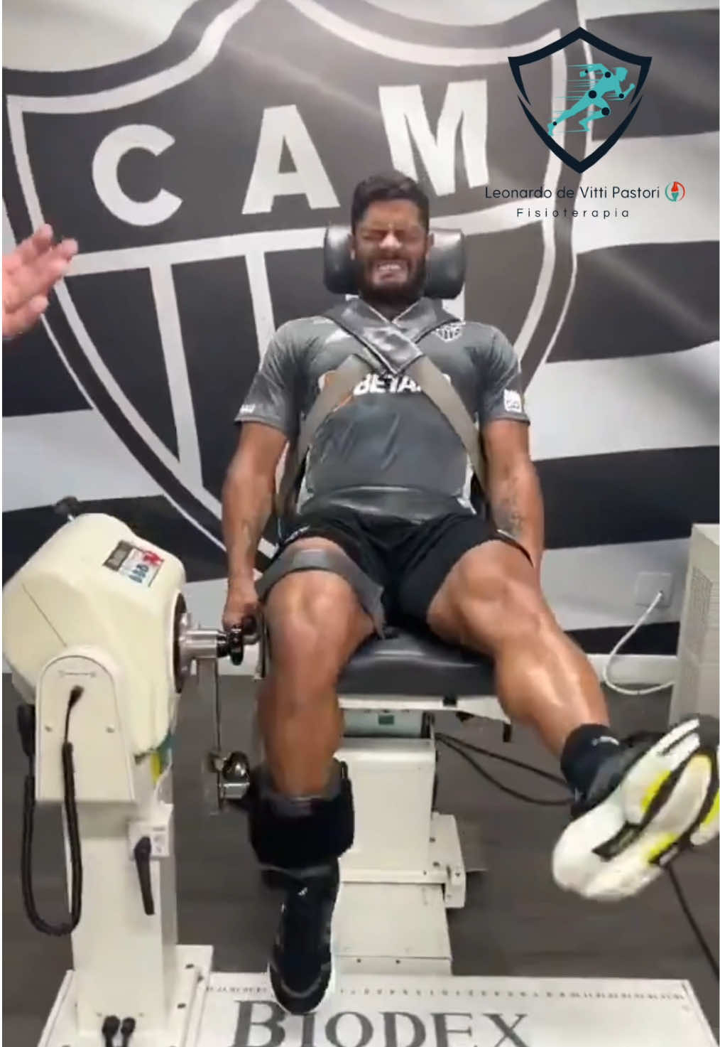 🦵🏻⚽️ Teste de Força com Dinamômetro Isocinético No vídeo, jogadores do Atlético Mineiro realizam o teste de força com o dinamômetro isocinético para membros inferiores, uma tecnologia avançada que mede a força muscular de forma precisa e segura! 🔎 O que é o dinamômetro isocinético? É um equipamento que avalia a força muscular em diferentes velocidades, oferecendo resistência controlada ao longo do movimento. Ele permite mensurar desequilíbrios entre músculos ou lados do corpo, essencial para a prevenção de lesões e otimização do desempenho atlético. 🔷 Para que serve? 	•	Identificar desequilíbrios musculares. 	•	Acompanhar a recuperação de lesões. 	•	Orientar treinos específicos. 	•	Melhorar a performance esportiva. 🛠 Tipos de dinamômetros Além do isocinético, existem outros tipos: 	•	Isométrico: Mede a força gerada sem movimento articular. 	•	Dinâmico: Avalia a força em movimentos livres, como levantamento de pesos. 🎯 A avaliação com o dinamômetro isocinético é uma ferramenta indispensável para atletas de alto rendimento, garantindo segurança e máximo potencial nos gramados! #fisioterapia #dinamometro #hulk 