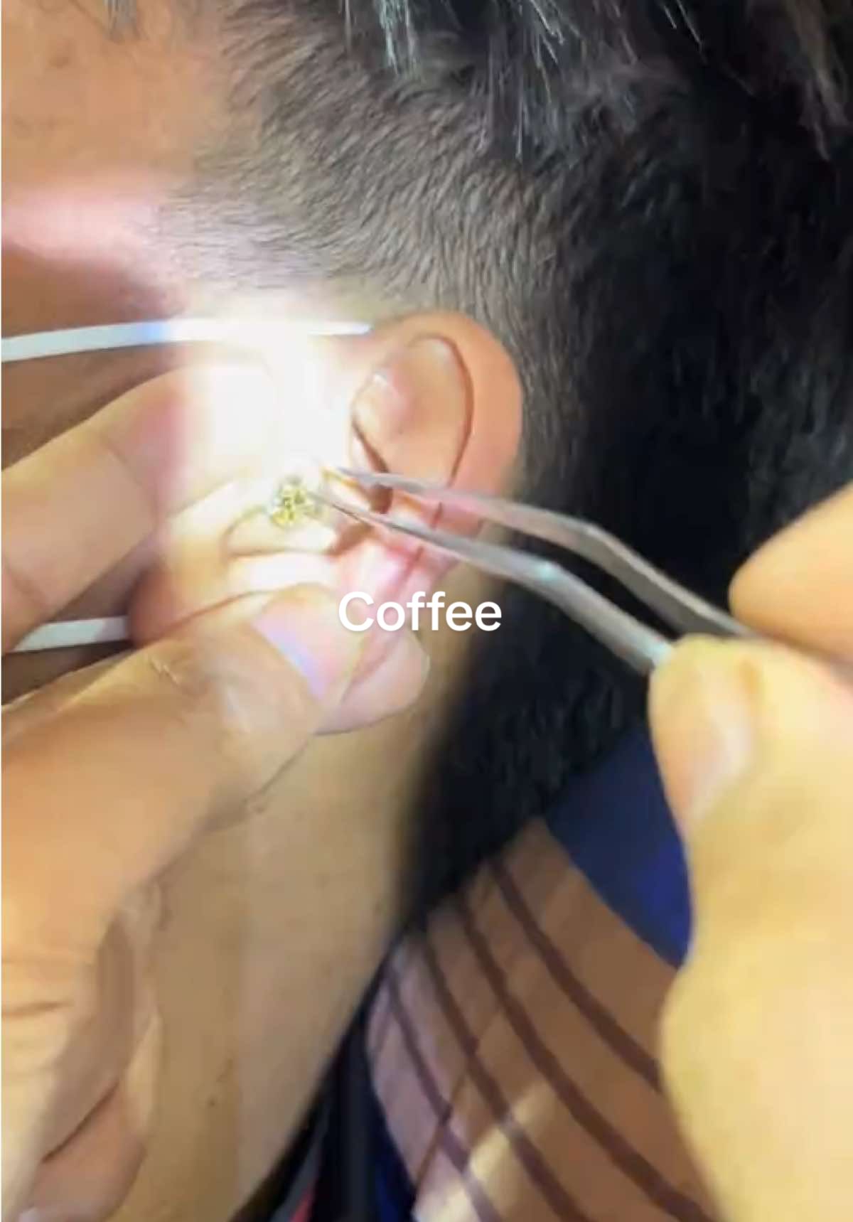 #ear #wax #cleaning #removal #asmr @Earwax.Cleaning @seyhano.2 @siha12288 