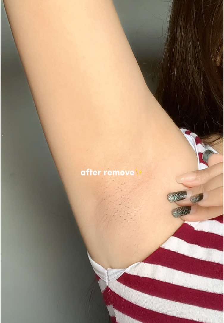 emg masih ada yg bersihin bulu keti pake sakit2an ya? #hairremoval 