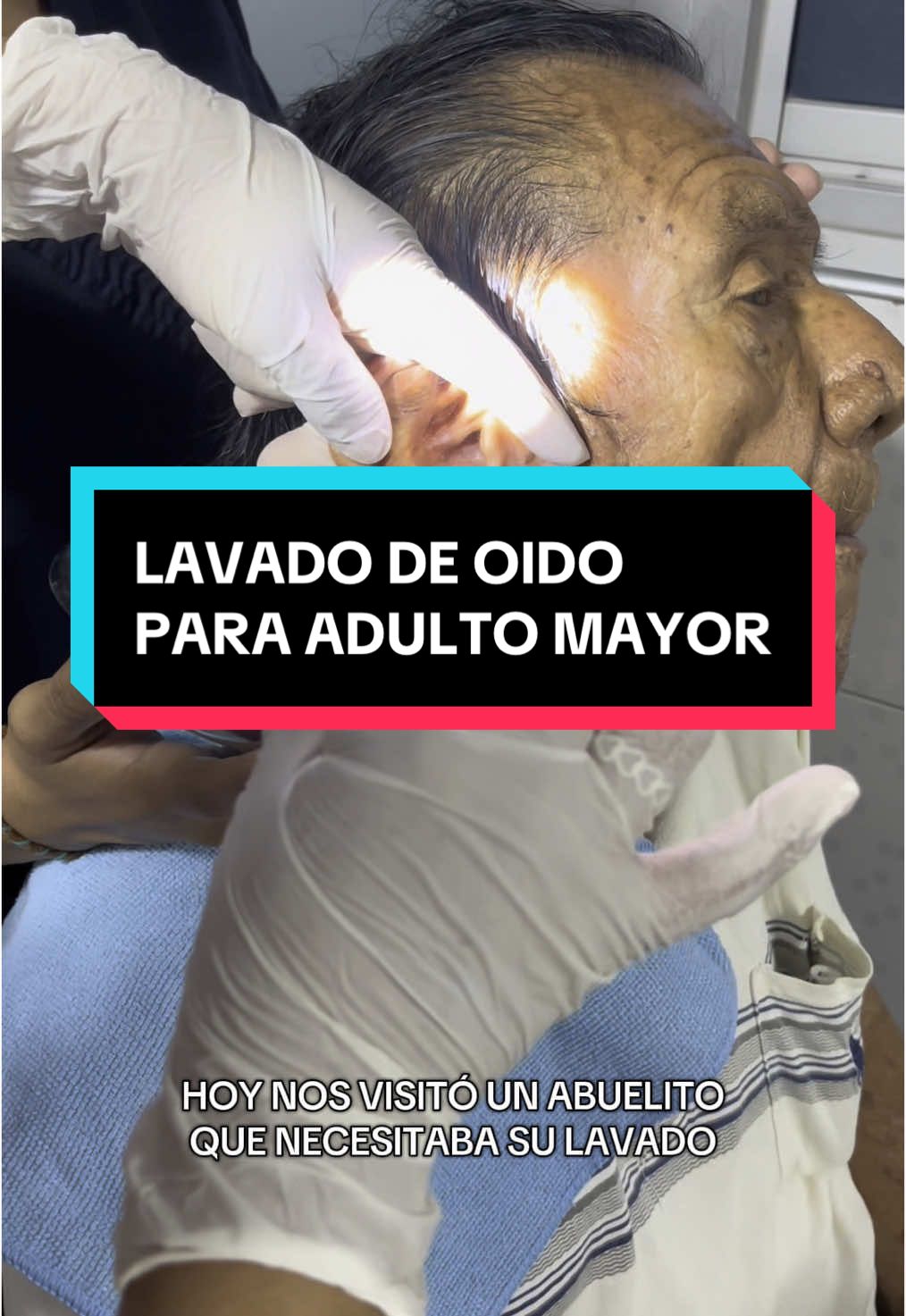 Para la realización de audífonos para escuchar mejor, te piden un lavado de oído antes, por ello hoy nos visitó un adulto mayor. Con mucha paciencia y cuidado pudimos realizarle con éxito su lavado correspondiente. #Otorrinos #Chiclayo #lavadodeoidos #adultomayor 
