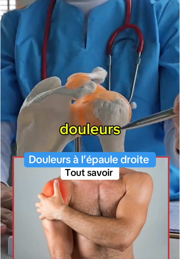 Tout savoir sur les douleurs aux épaules #cause #medical #douleur 