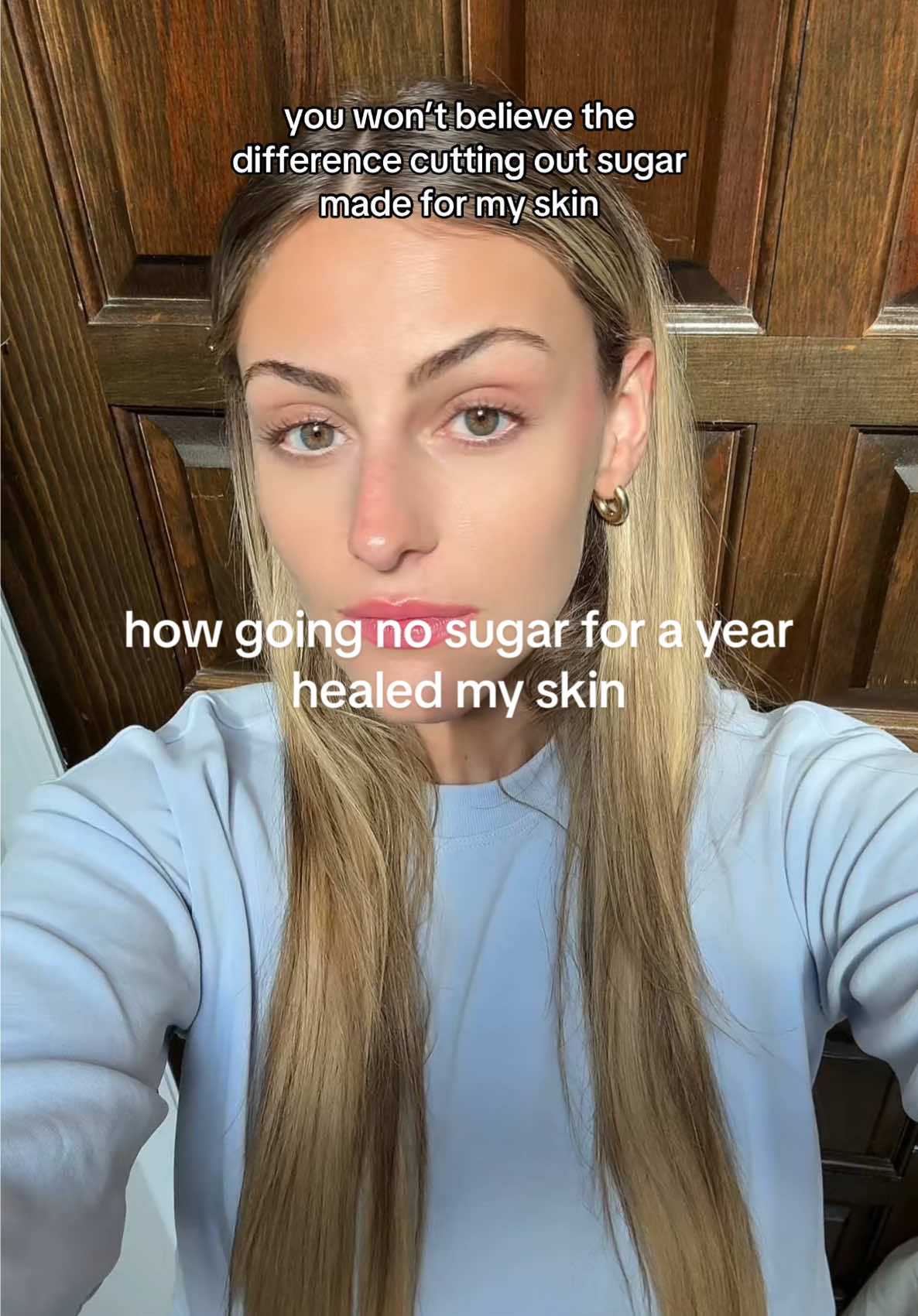 if you have facial inflammation or skin issues, cutting out sugar might be your answer 👀👀👀 I post a bunch of my no sugar diet recipes, tips, grocery hauls and more on my page!! let me know what questions you have, and what your thoughts are in the comments 🤍 it’s amazing what happens when you cut out added sugar :)) #NoSugar #NoSugarResults #RefinedSugar #NoSugarTransformation #InflammationHealing #SugarInflammation #FacialInflammation #SkinInflammation #FoodsThatCauseInflammation #ClearSkinJourney #NoSugarDiet #HealthySkin #SkinTransformation #SugarFree #HealYourBody  #creatorsearchinsights 