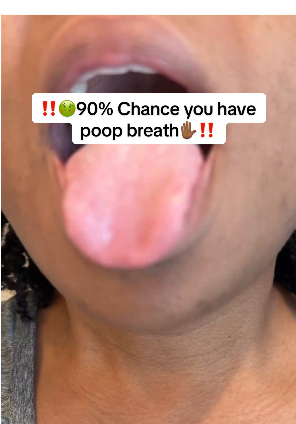 Just 1 pill a day keeps the poop breath away‼️#creatorsearchinsights #badbreath #bodyodor #chlorophyll 