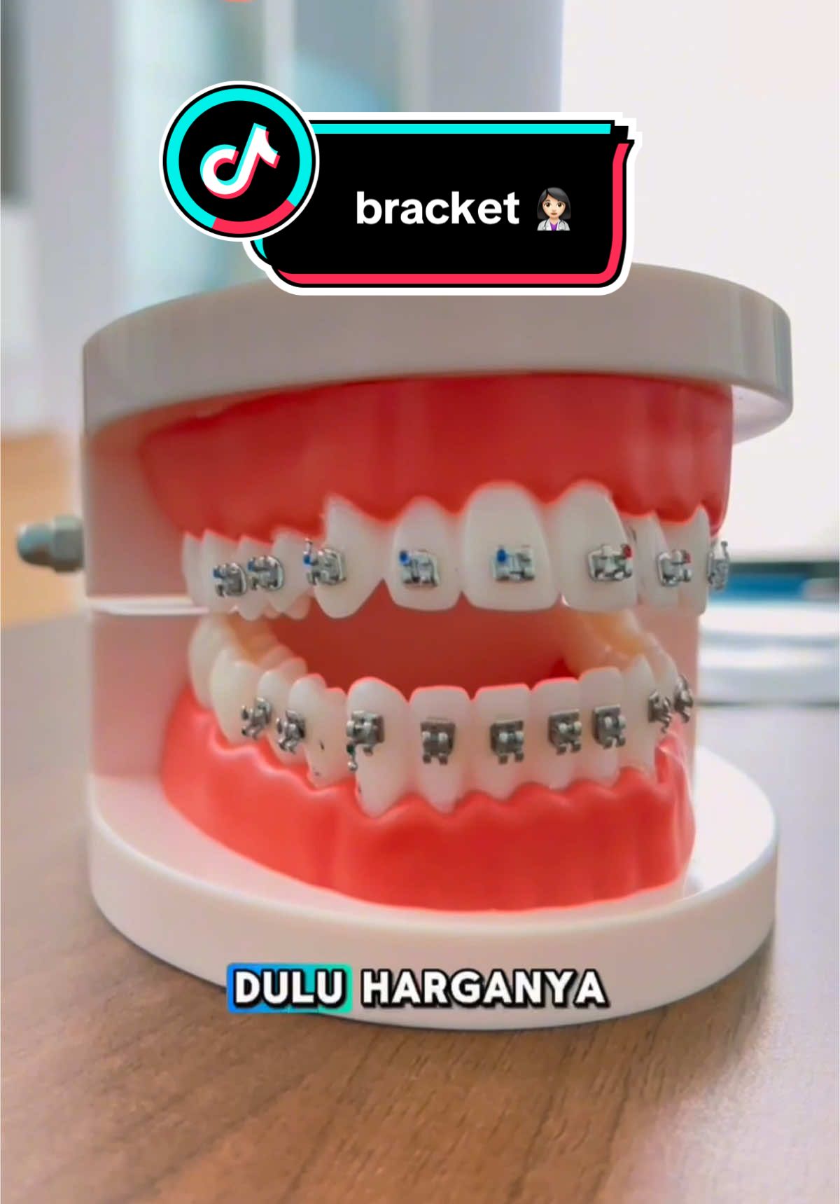 yang butuh stok bracket dental sekarang bisa kalian dapatkan di onemed 👍🏻  #fyp #onemed #medicom #dental #bracket #behelgigi 