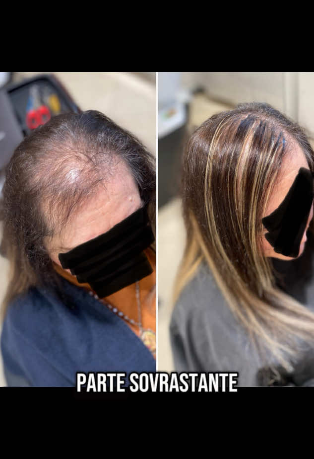 Infoltilmento coldhair  🌟 Ti senti insoddisfatto dei tuoi capelli sottili e diradati? Non è mai troppo tardi per ritrovare una chioma più folta! Il nostro trattamento di rinfoltimento capelli è la soluzione che cercavi. Grazie a tecniche innovative e naturali, potrai ottenere risultati visibili subito! ✨ 👉 Sei pronto per una chioma più folta? Prenota subito la tua consulenza  #perte #hair #newlook #pamidea #hairstyle 