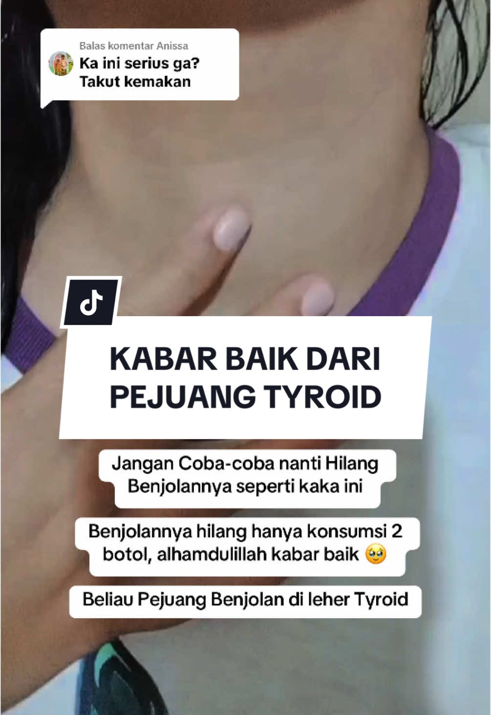 Membalas @Anissa #pejuangkanker #kista #kistaovarium #benjolan #kankerserviks #tipskanker #gondokberacun #gejalakanker #gondokberacun #gejalakanker #pengalamanhidup #fyp 