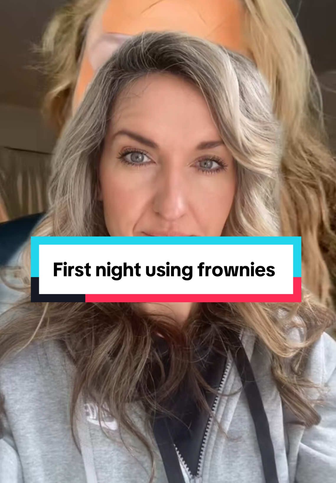 #onthisday authentic customer testimonies about their experience using frownies! Frownies smooth and soften expression lines and are also great as a preventative treatment for anyone considering Botox as prevention. Frownies make it so easy and so much more affordable! #frownies #wrinkleprevention 