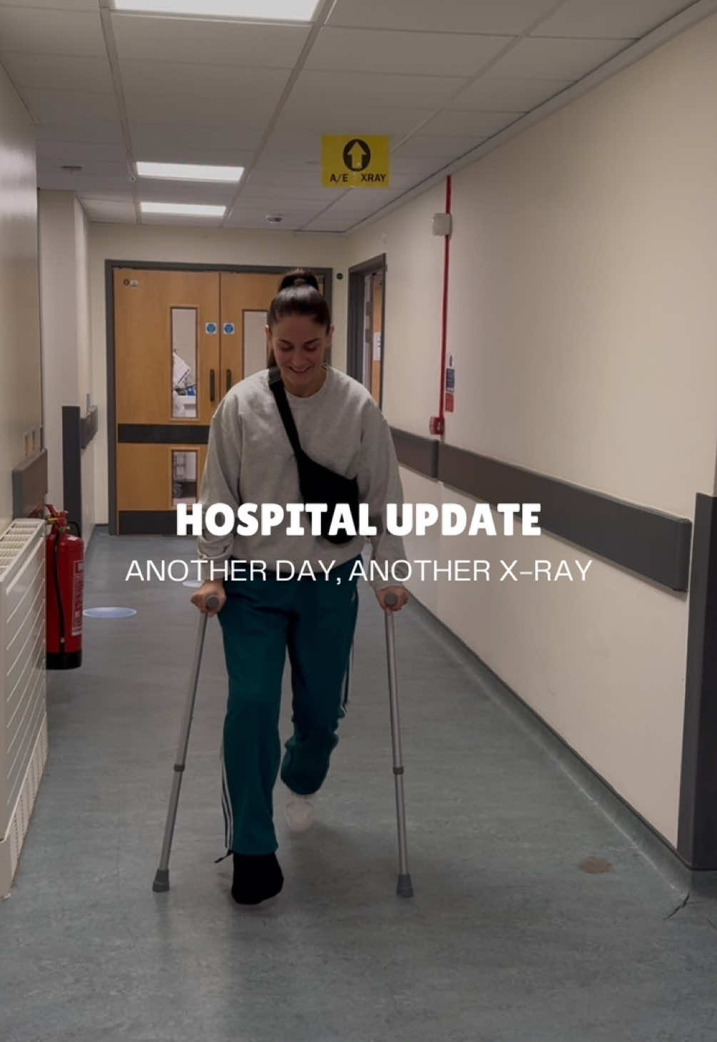 Replying to @Sarah_Debk  HOSPITAL UPDATE -  Yesterday I had my second hospital trip for an x-ray since breaking my leg just over 2 weeks ago 🏥.  The aim of this x-ray was to check whether or not my bone had displaced from its original position and whether surgery would be needed to realign it.  📆 Next x-ray - 19/03.  #brokenleg #brokenlegjourney #roadtorecovery #hospital #xray #football #footballinjury #WomensFootball #woso #fracturedtibia 