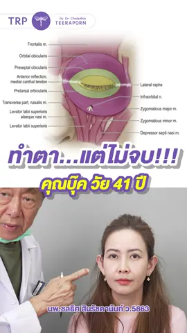 ทำตาสองชั้น ต้องดูทั้งรอบดวงตา EYE CONTOUR คือคำตอบสำหรับผู้หญิงวัย 40+ #microlock #รีวิวดึงหน้า #ดึงหน้าที่ไหนดี #ศัลยกรรม #ทำตา