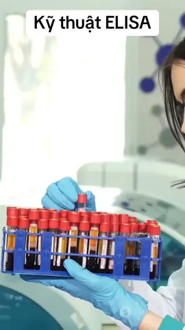 Khám phá công nghệ xét nghiệm miễn dịch ELISA trong video này! 🎤 Chúng ta sẽ cùng tìm hiểu cách phát hiện kháng thể và kháng nguyên trong máu một cách chính xác bằng kỹ thuật ELISA, một quá trình dựa trên phản ứng kháng nguyên-kháng thể. Từ việc lấy mẫu đến phản ứng tạo màu giúp đo nồng độ mục tiêu, mọi bước đi sẽ được giải thích rõ ràng.  ✅ ELISA ứng dụng trong nhiều lĩnh vực như phát hiện virus, xét nghiệm dị ứng, kiểm tra nồng độ hormone và đánh giá hiệu quả của vắc-xin. Hãy cùng xem video để hiểu rõ hơn về công cụ quan trọng này trong chẩn đoán y khoa!  Nếu bạn thấy video hữu ích, hãy like và chia sẻ nhé! #ELISA #XetNghiem #YHoc #KhoaHoc