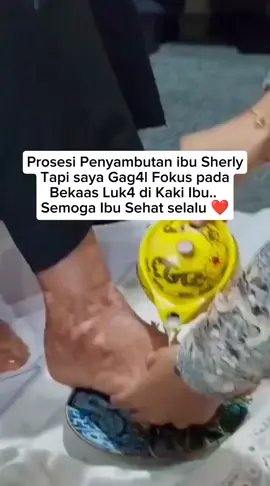 sehat slalu ibu gubernur #sherlytjoanda 😇 Sedih lihat bekas luka di kaki ibu🥺 Wanita hebat🥰 #jangkauanluastiktok  #jangkauanluasfyp  #gubernurmalukuutara 