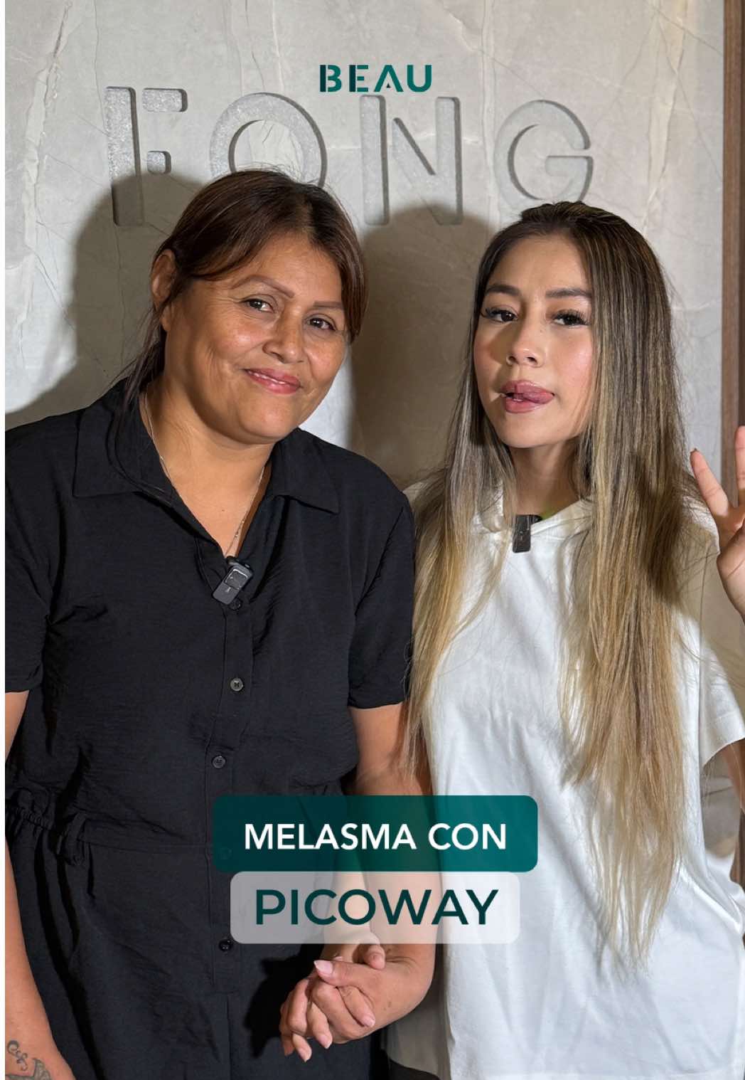 🤗Milenka hoy nos visitó con Anita para hacerle el Láser Picoway ✨☺️ No olvides agendar tu cita al 915192633 🤗 #fyp #foryou #picowaylaser #viral #picoway #beau #belleza #laser #parati #drfong #piel #docfong @Milenka_nolasco🐩💗@anita 1518 @Dr Fong Estético @Cirugía Estética Fong 