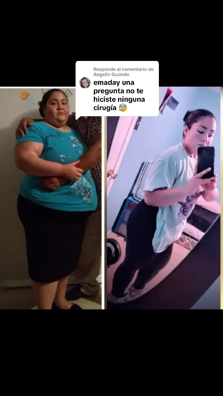 Respuesta a @Angelin Guzmán mis logros son libres de cirugías proudictis mágicos son 3 años de comer saludable y ejercicio con peso eh perdido más de 180 lb #antesydespues #motivaciongym #beforeandafter #plato 