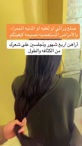 #تطويل_الشعر_ونعومة_مثل_الحرير #ثعلبه #صلع #كثافه_الشعر #نعومة #مالي_خلق_احط_هاشتاقات #هاشتاق #رمضان 
