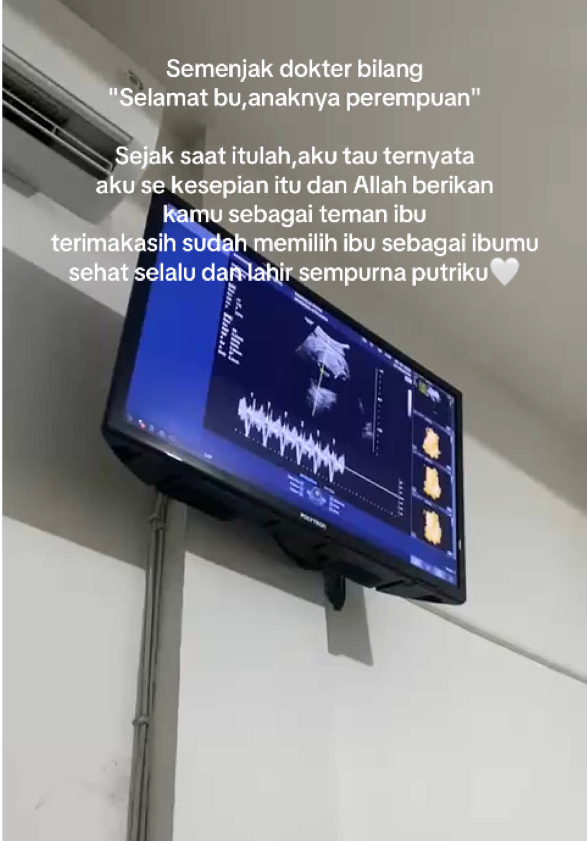 MasyaAllah🥹🤍 #bumil #tm3 