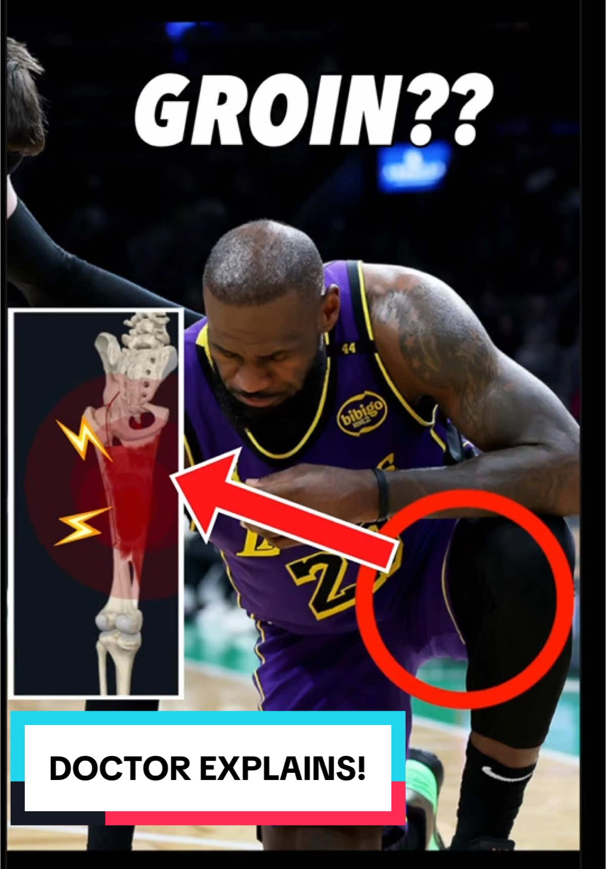 #Lakers LeBron James left tonights game against the Celtics after suffering a left groin injury & didn’t return, lets break this down  #Medspiration . . . #anatomy #lebronjames #kingjames #lebron #lakersnation #lakeshow #losangeleslakers #sportsmedicine #espn #sportscenter #sportstiktok #science #injury 