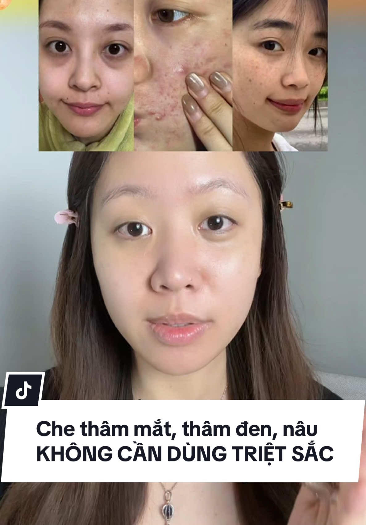 Cách che thâm mắt, thâm đen, nâu, thâm nặng, nám tàn nhang KHÔNG CẦN DÙNG TRIỆT SẮC ✨ #janehere #janehereofficial #makeup #makeuptutorial #makeupcanhan #LearnOnTikTok #khoamakeupcanhan2025 #thuvienmakeup #abouttone #skinlayerfit 